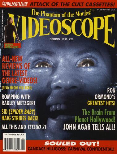 Videoscope